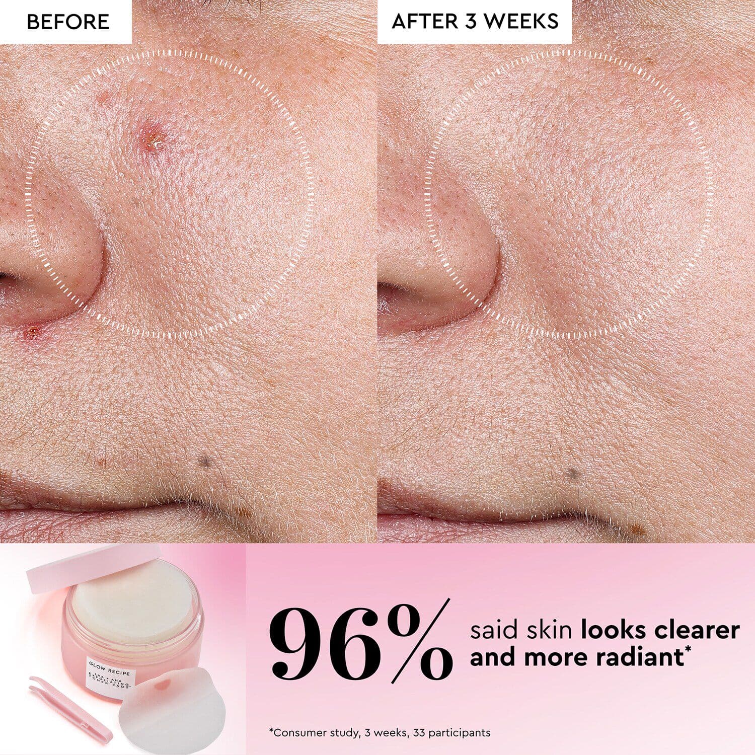 LHA + AHA Exfoliating Korean Toner Pads for Smooth &Hydrated Skin