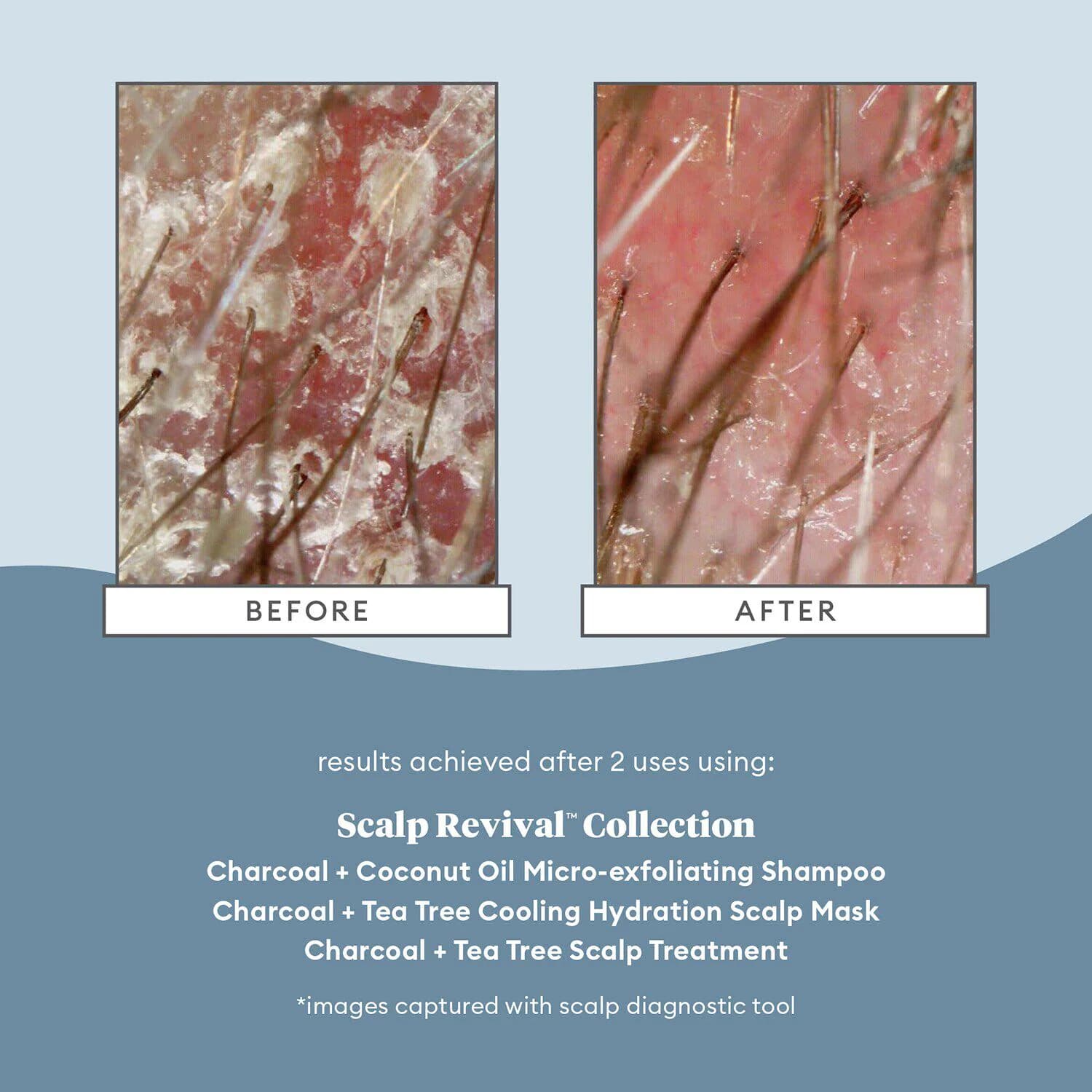 Scalp Revival™ Charcoal + Tea Tree Cooling Hydration Mask