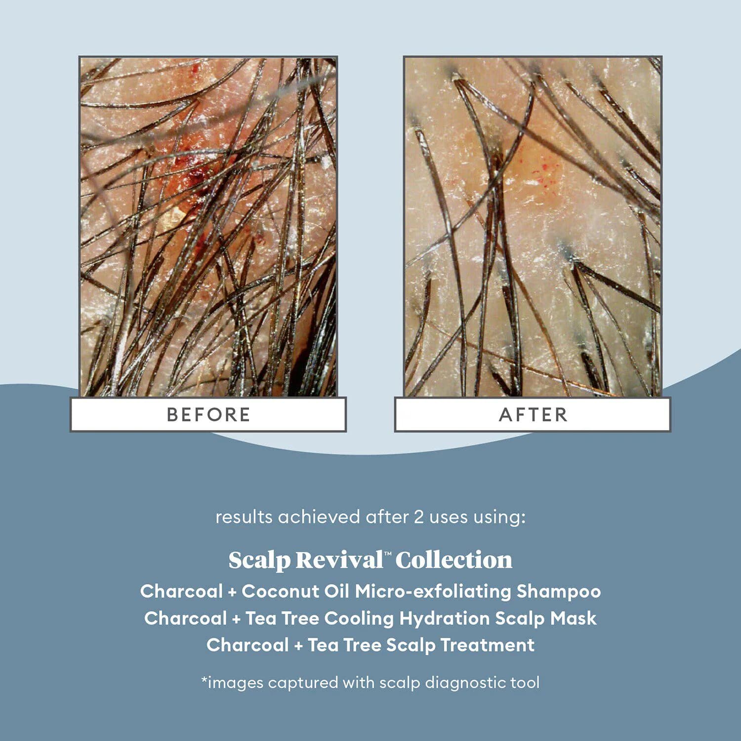 Scalp Revival™ Charcoal + Tea Tree Cooling Hydration Mask