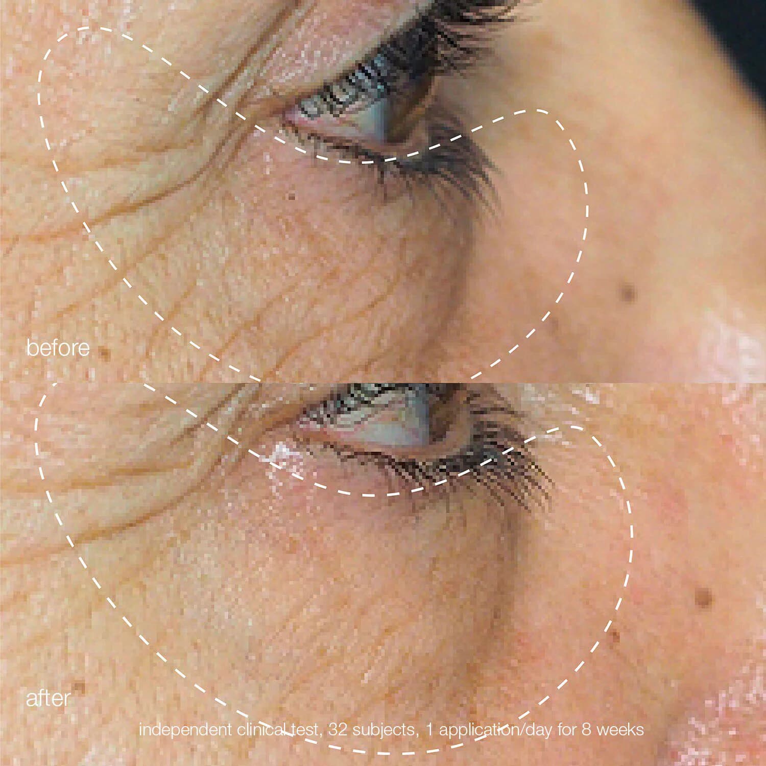 Awaken Peptide Depuffing Eye Gel