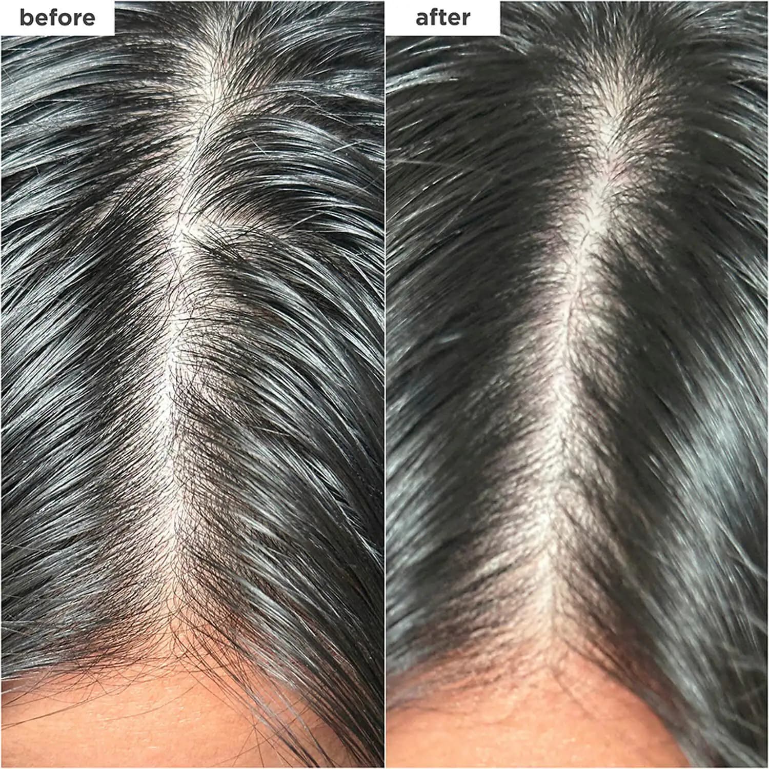 Scalp Revival™ Charcoal + Biotin Dry Shampoo