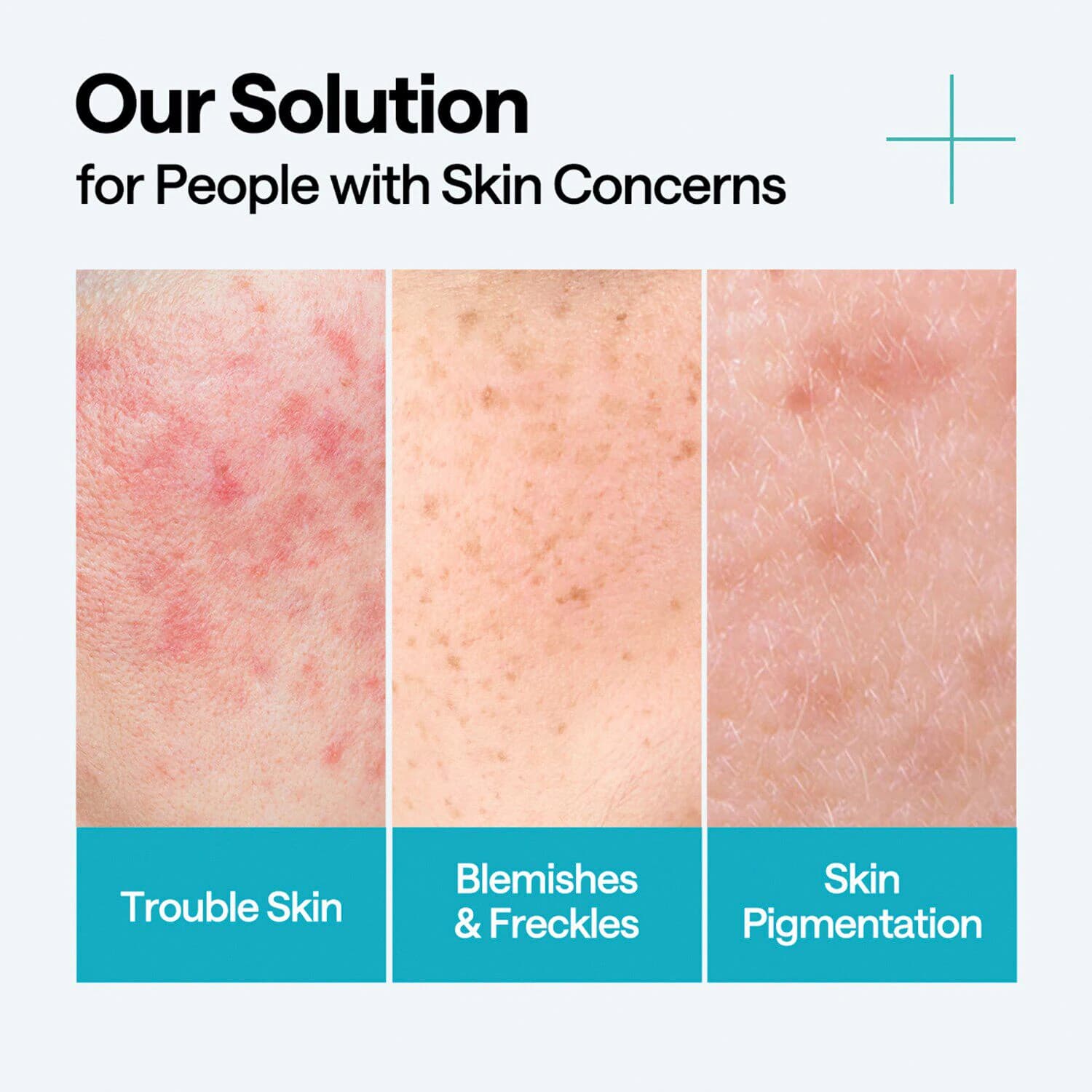 Madecassoside Serum